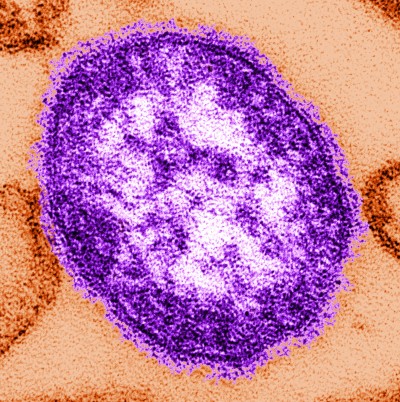 Respuestas a 10 preguntas frecuentes sobre el sarampión